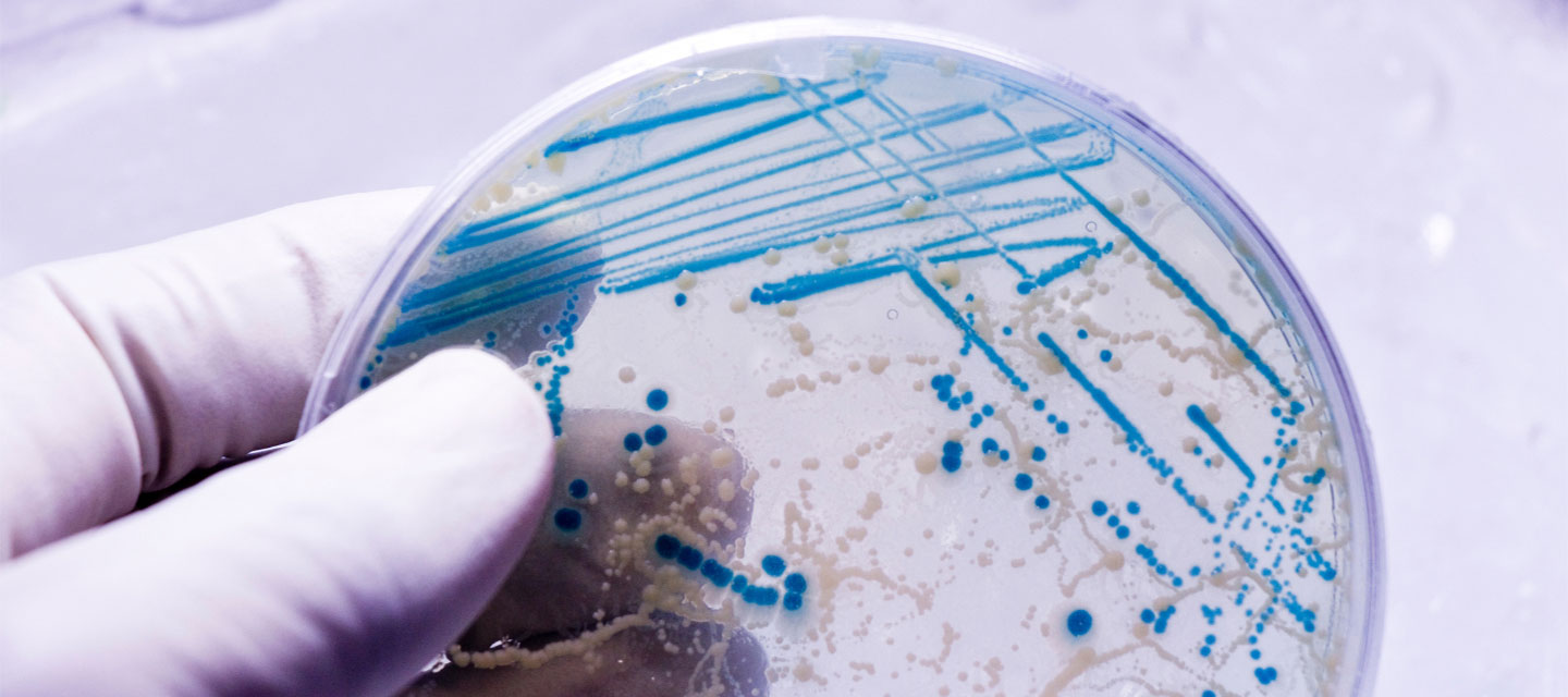 image of a hand holding a petri dish with cultures growing on it; molecular and cellular biology