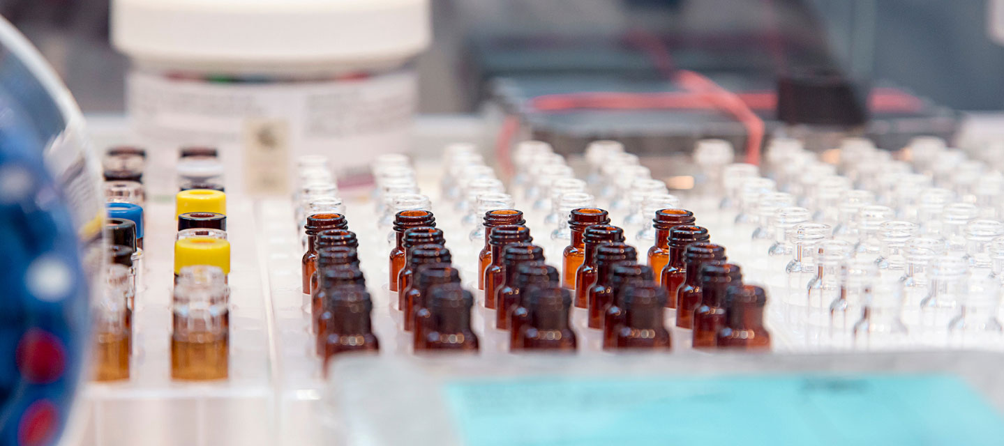 test tubes and sample bottles lined up on table; clinical laboratory science